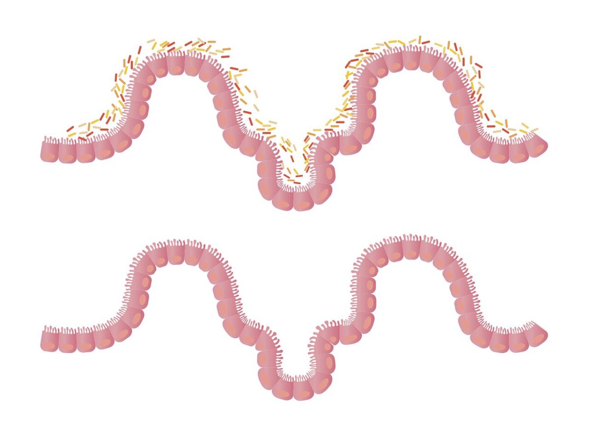 Microbiota e metabolismo: il batterio che migliora la salute