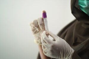 Nuovo test salivare contro il cancro: diagnosi in pochi minuti