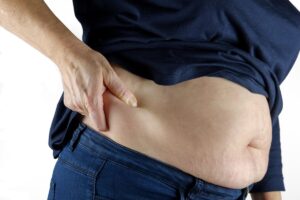 Obesità: presto verrà riconosciuta come malattia?