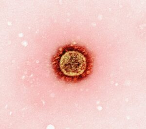 Morbillo: il ritorno della malattia che sembrava sconfitta