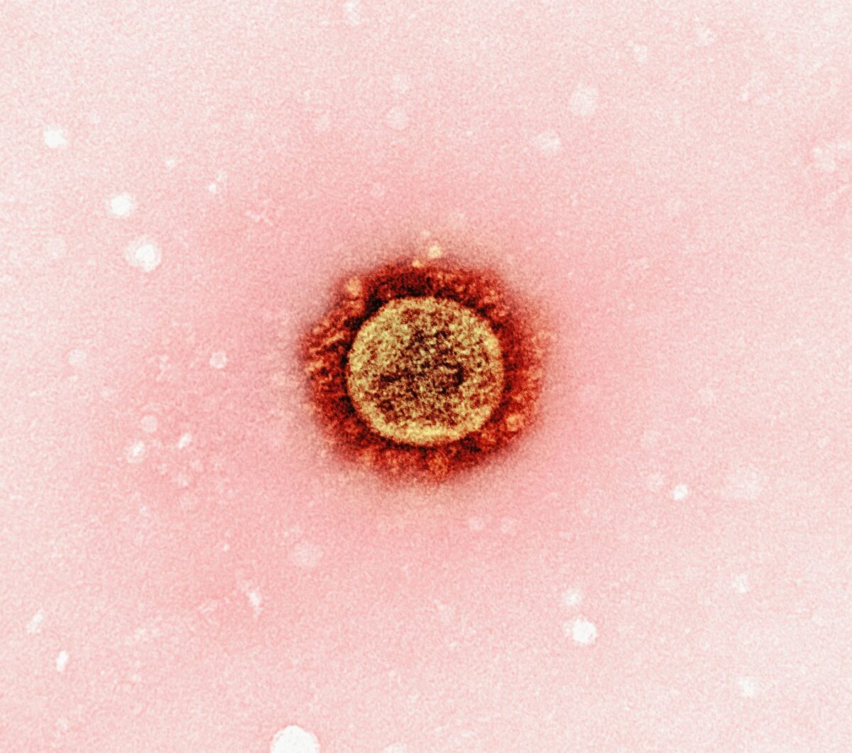 Morbillo: il ritorno della malattia che sembrava sconfitta
