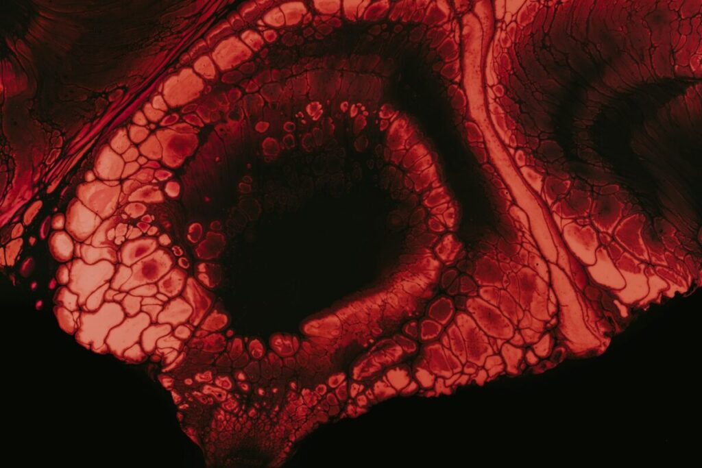 Anemia, basta una foto dell’occhio per scoprirla Anemia, basta una foto dell’occhio per scoprirla