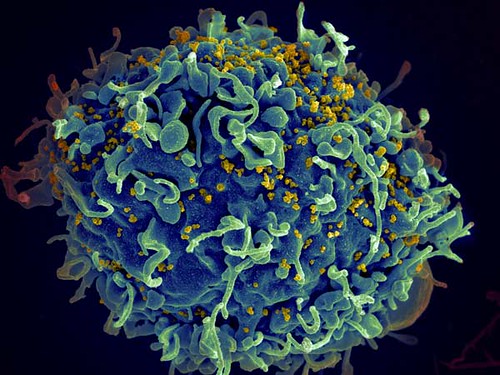Lotta all’HIV: presto basteranno due iniezioni per vincere il male del secolo Lotta all’HIV: presto basteranno due iniezioni per vincere il male del secolo