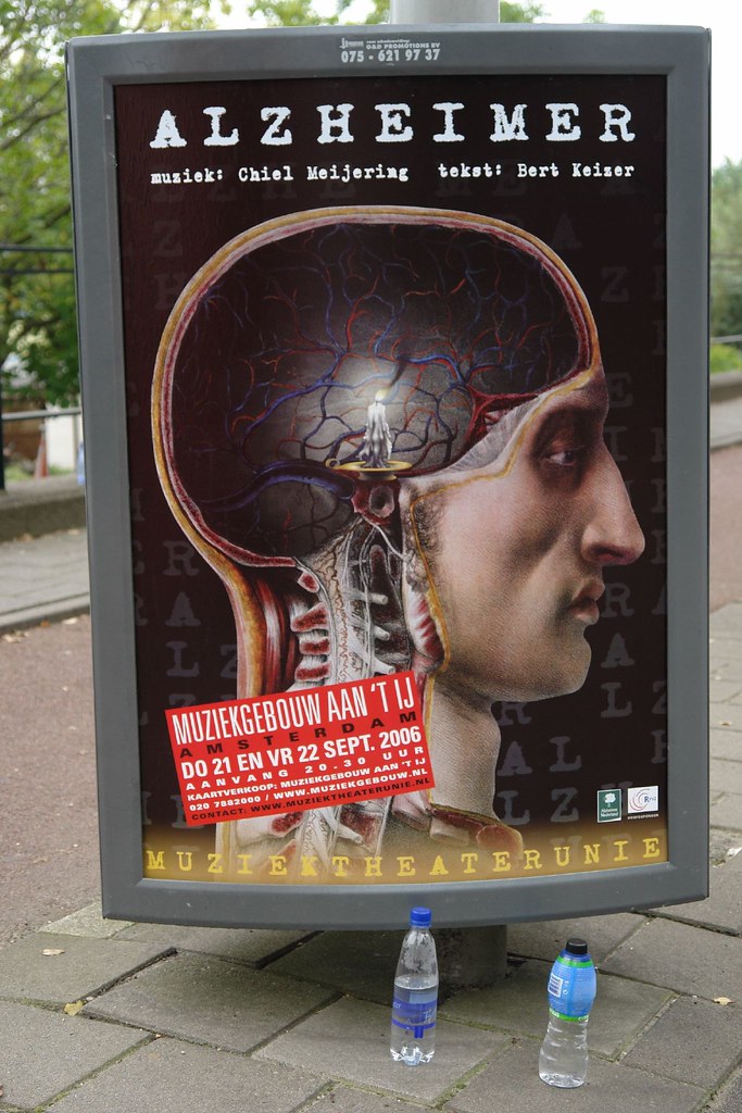 Scopriremo l’Alzheimer con un test del sangue? Il nuovo brevetto fa sperare Scopriremo l’Alzheimer con un test del sangue? Il nuovo brevetto fa sperare