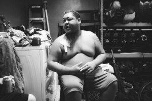 Mounjaro®: L’Innovativo Trattamento per la Perdita di Peso