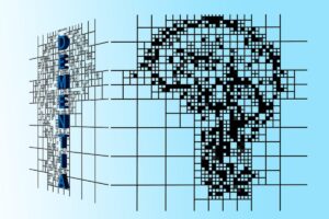 Alzheimer, scoperto il “grilletto molecolare” che lega infiammazione e beta-amiloide alla perdita di memoria