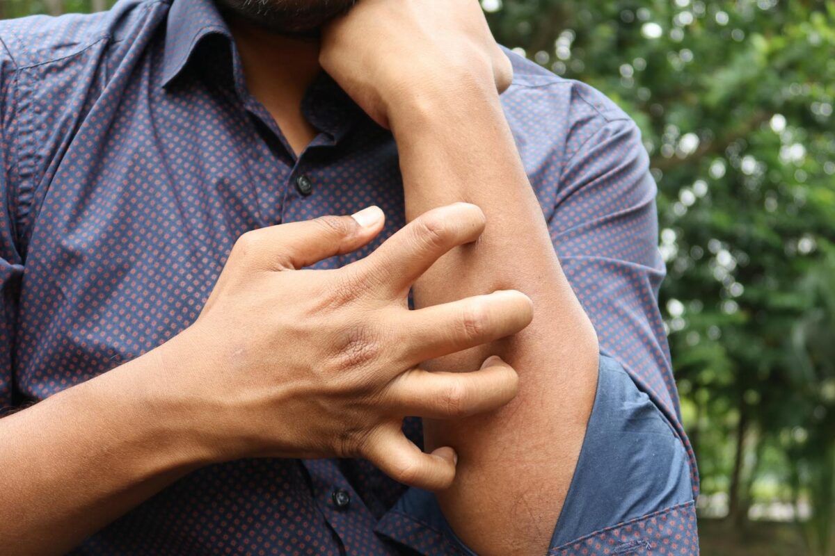 Ansia e prurito: quando il corpo parla dello stress e come intervenire