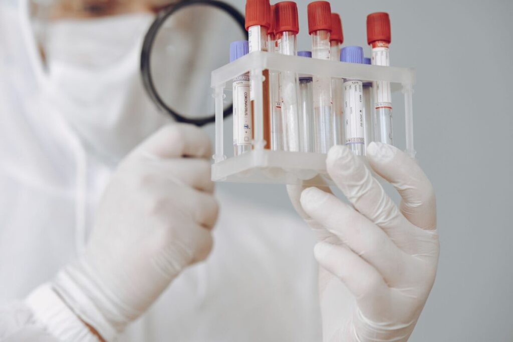 Epatite A in crescita nel Lazio: lo Spallanzani segnala focolai legati a cibi contaminati Epatite A in crescita nel Lazio: lo Spallanzani segnala focolai legati a cibi contaminati