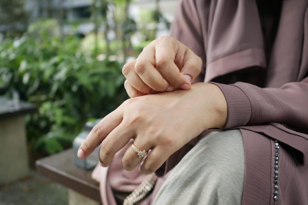 “Malattia della pioggia”, perché se ne parla ora: il batterio degli animali che sta passando tra le persone “Malattia della pioggia”, perché se ne parla ora: il batterio degli animali che sta passando tra le persone