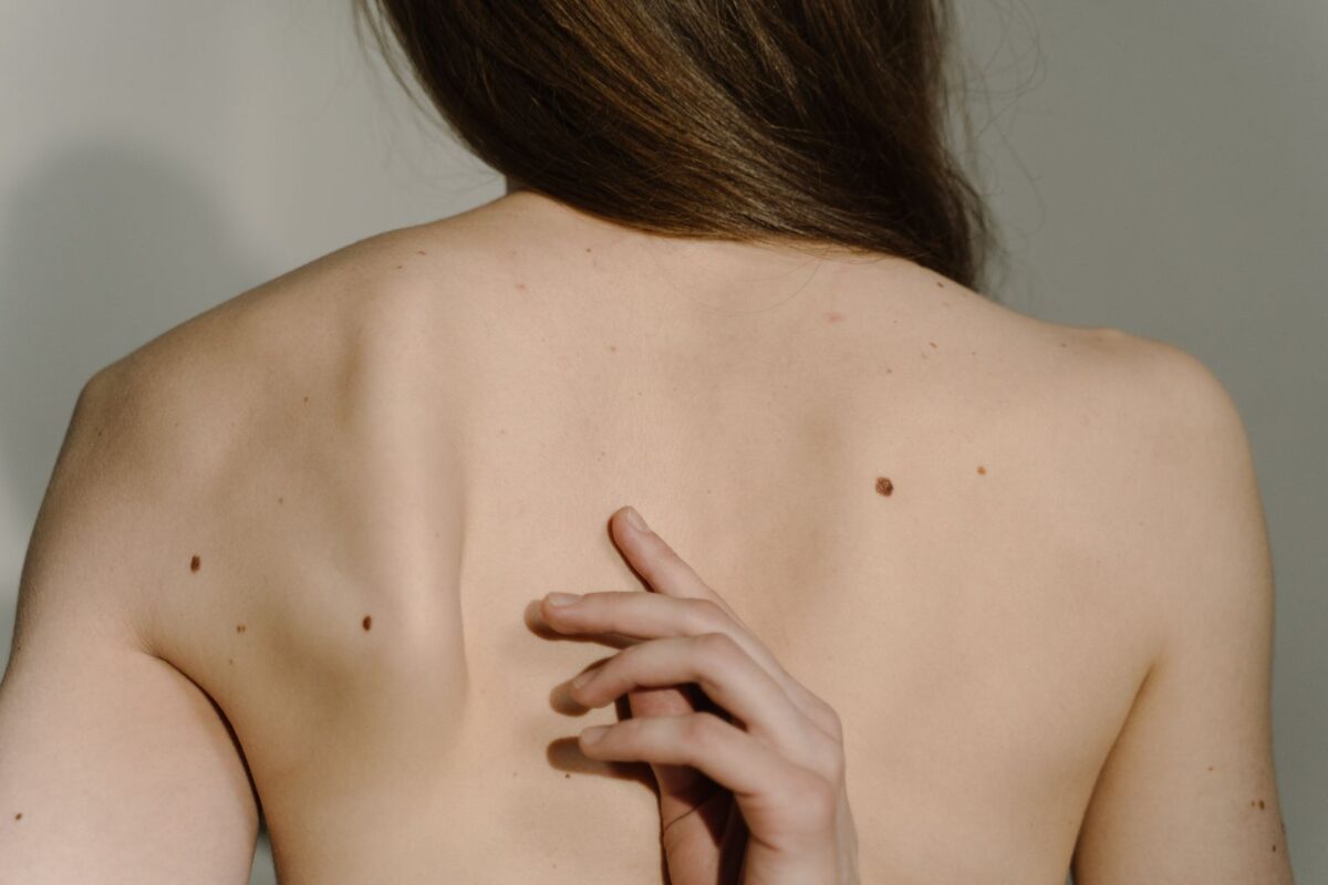 Vaccino personalizzato contro il melanoma: la svolta dell’mRNA che apre una nuova era in oncologia Vaccino personalizzato contro il melanoma: la svolta dell’mRNA che apre una nuova era in oncologia