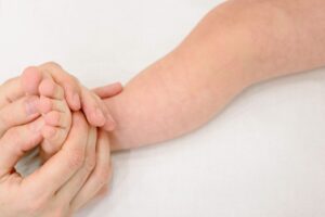 Morbillo, il Ministero richiama le Regioni: seconde dosi ancora lontane dal target e i casi crescono, soprattutto in Calabria